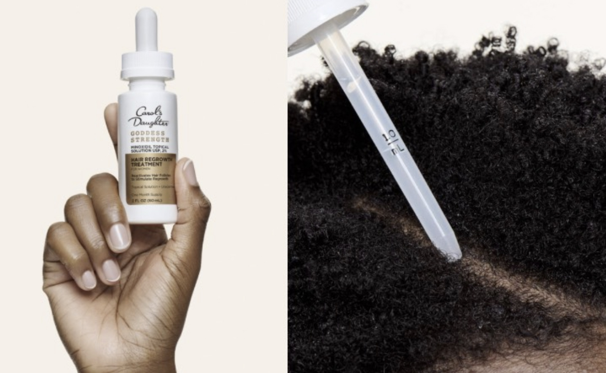 卡罗尔的女儿推出新的头发再生疗法